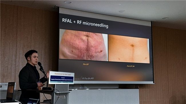 1733757442-ade1ee5e3a38a00 1733757442-ade1ee5e3a38a00